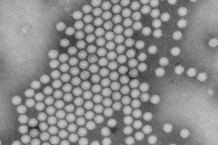 First U.S. Polio Case Since 2013 Is Confirmed in New York